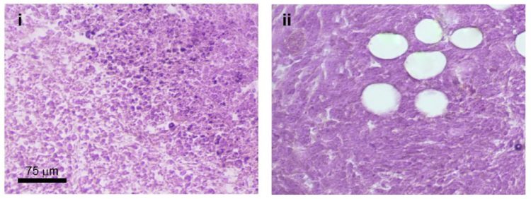 Images of mouse tumor samples, showing how tumor cells grow abnormally if they've been treated with the anti-cancer drug Taxol.