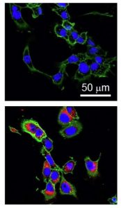 Images of mouse mammary cancer cells under a microscope.